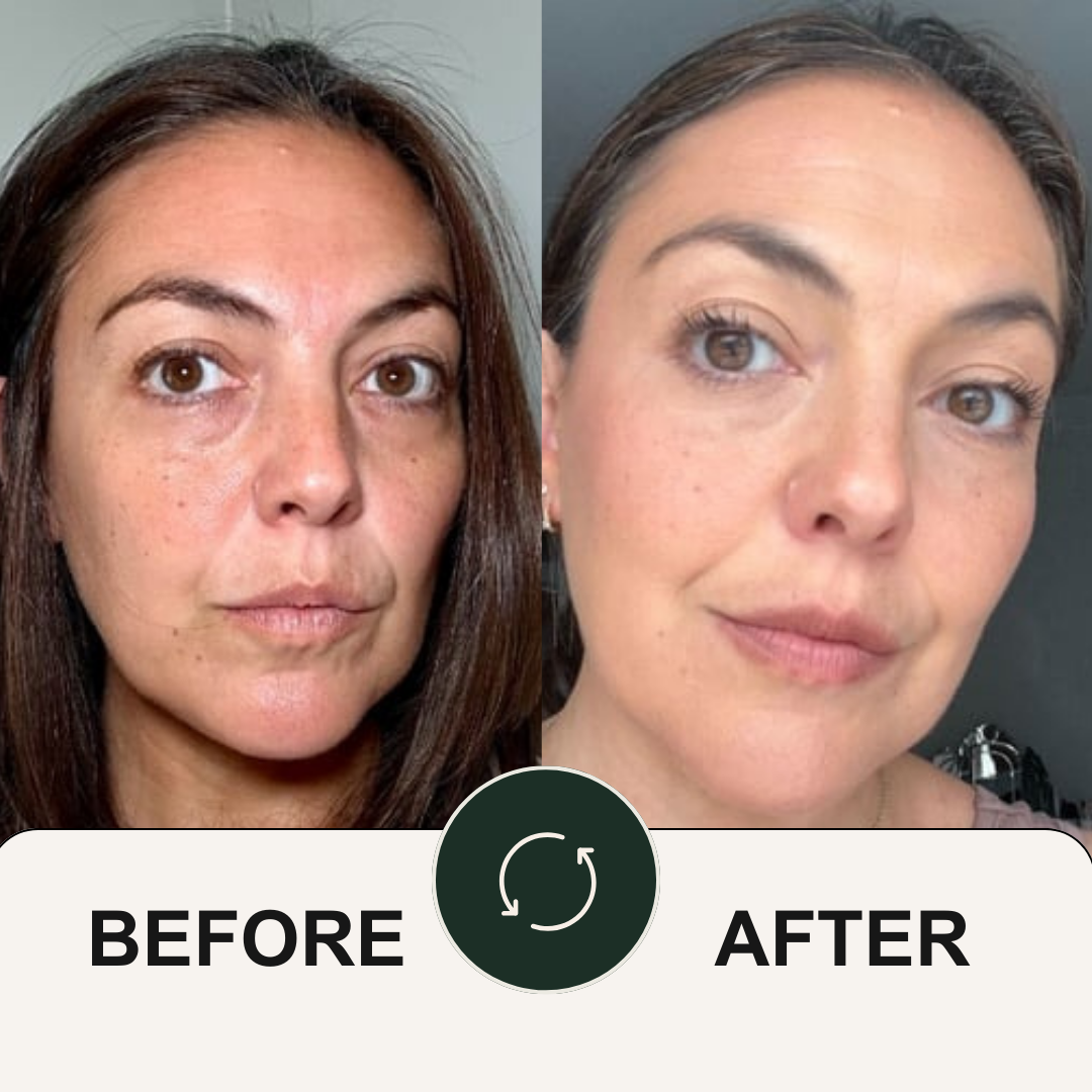Renewing Avocado Eye Mask